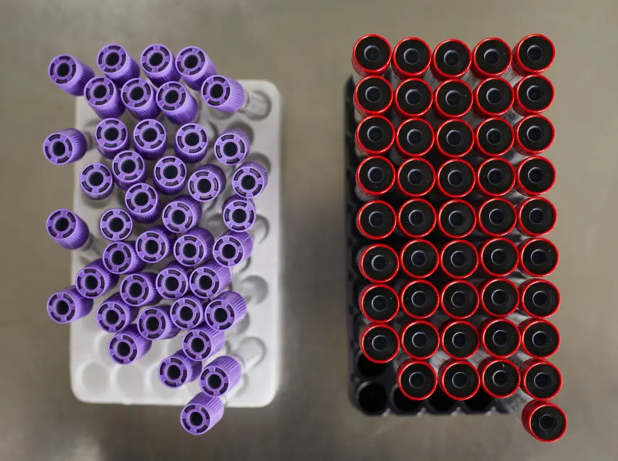 Choosing the right DNA extraction kit for research applications