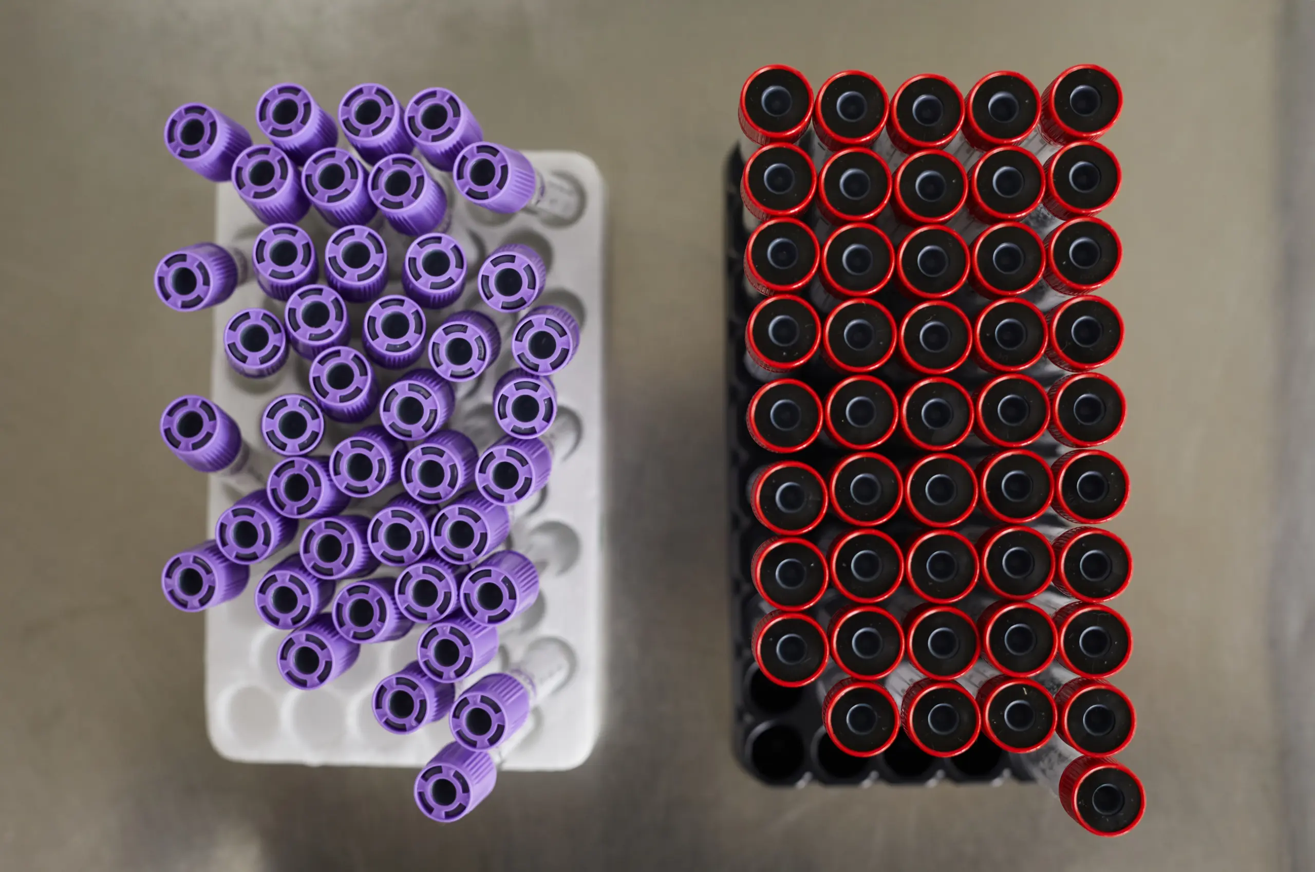 Choosing the right DNA extraction kit for research applications